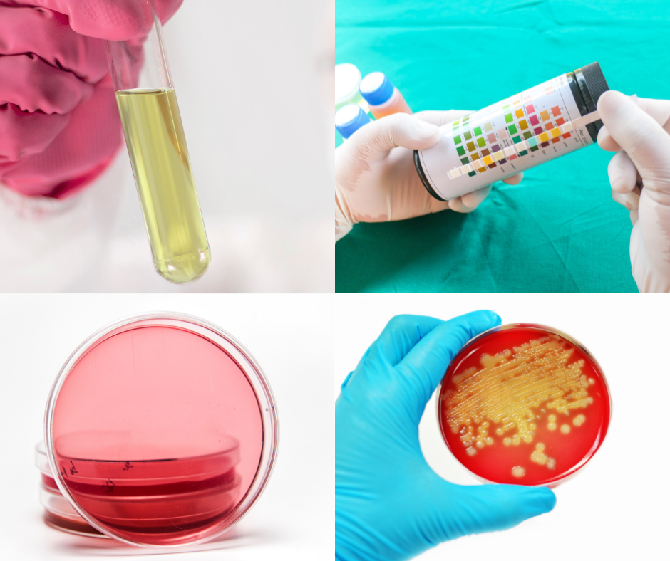 Urine tube, urine dipstick test, culture plates