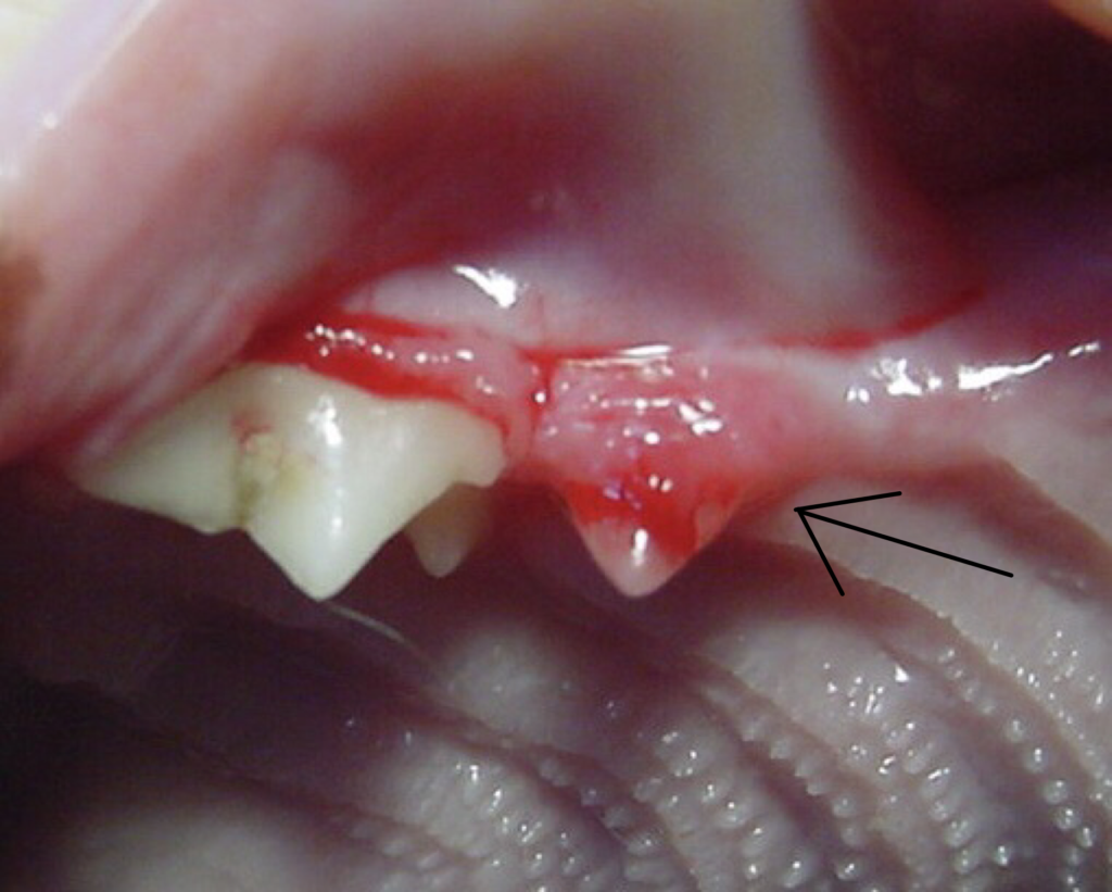 Tooth Resorption Image